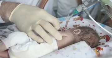 Почему дети рождаются 7 месячные дети Почему дети рождаются 7 месячные дети