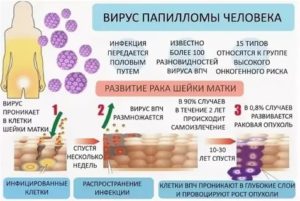 Какая может быть вирусная инфекция шейки матки