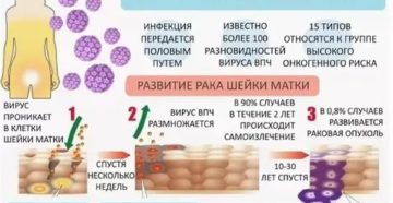 Какая может быть вирусная инфекция шейки матки
