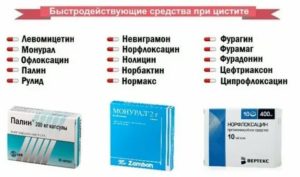 Можно ли принимать кеторол при цистите