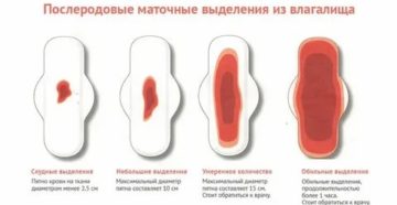 Какой цвет должен быть при месячных после родов