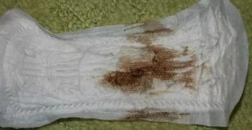 Почему месячные темные почти черные это нормально Почему месячные темные почти черные это нормально