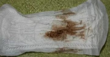 Почему месячные пришли с задержкой и были скудными Почему месячные пришли с задержкой и были скудными