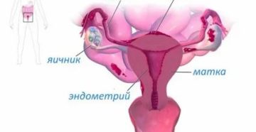 Как уменьшить эндометрий при менопаузе народными средствами