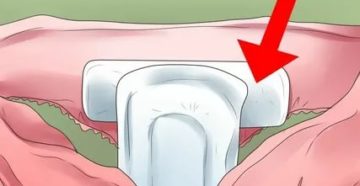 Как правильно пользоваться прокладками во время месячных