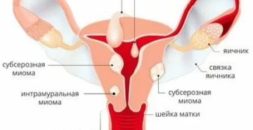 Почему может быть увеличена матка у женщины перед месячными Почему может быть увеличена матка у женщины перед месячными