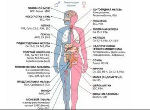 Как называются онкомаркеры матки