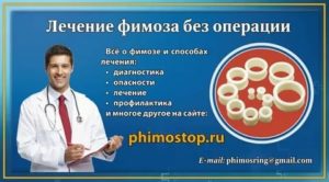 Кто вылечил фимоз без операции отзывы