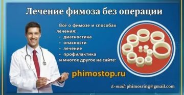 Кто вылечил фимоз без операции отзывы