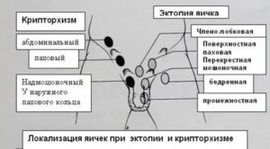 Когда опускаются яички у мальчиков узи