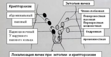 Когда опускаются яички у мальчиков узи