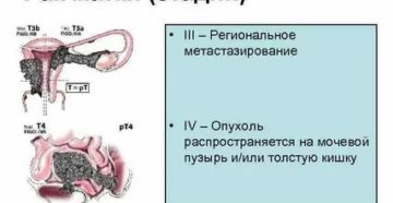 Что такое метастазы при раке кишечника в матку