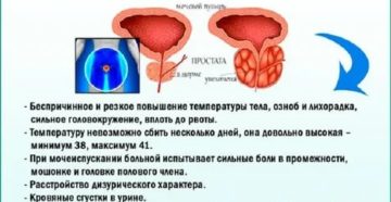 Сколько длится приступ простатита