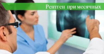 Можно ли делать рентген поясничного отдела во время месячных