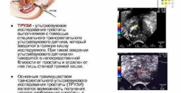 При узи предстательной железы за сколько времени пить воду и сколько