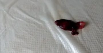 Что делать если первые месячные идут уже 6 день