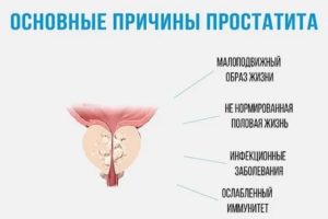 Сколько лет можно прожить с хроническим простатитом
