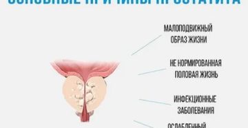 Сколько лет можно прожить с хроническим простатитом