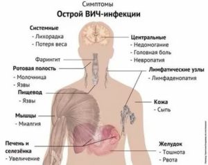 Какие есть болезни с симптомами похожие на вич