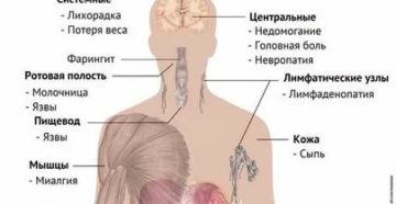 Какие есть болезни с симптомами похожие на вич