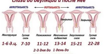 Какие симптомы перед месячными у женщин за сколько дней