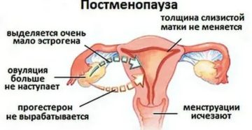 Можно ли разбудить яичники в менопаузе